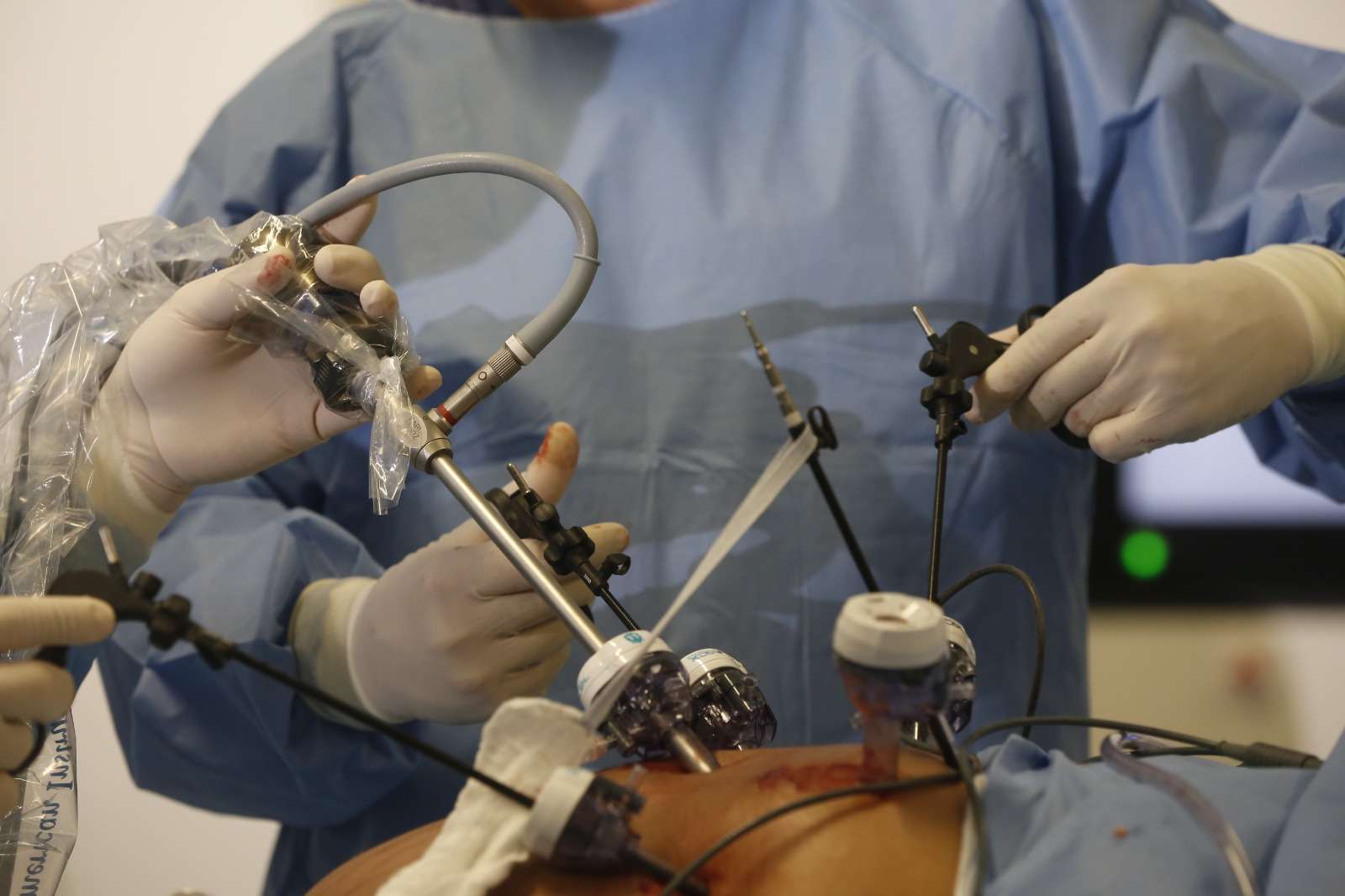 gynecologist in indore, laparoscopic gynecologist in indore,