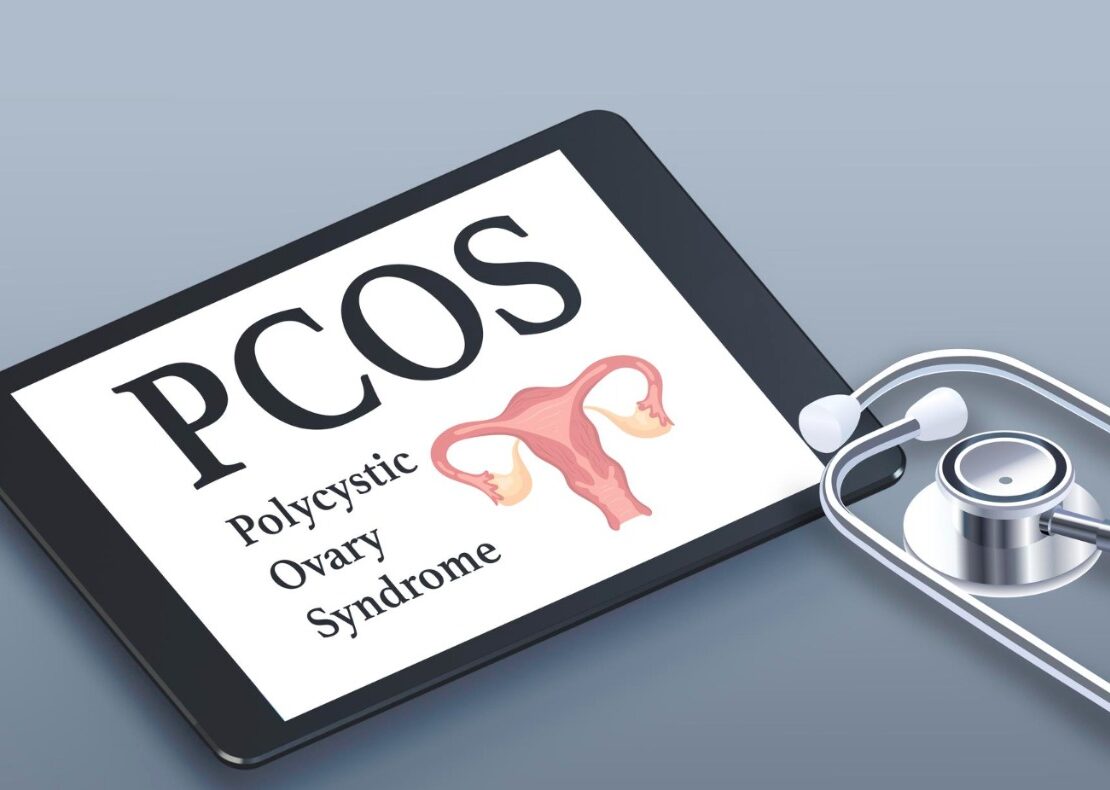 pcos treatment in Indore