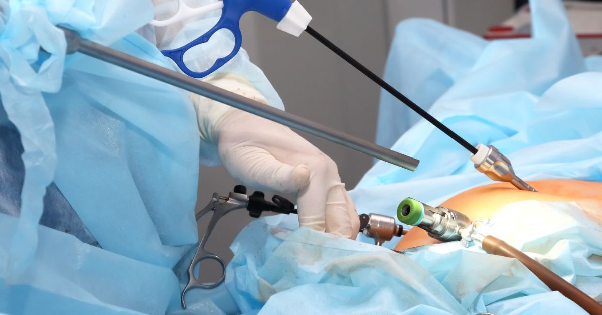 laparoscopic surgery Indore